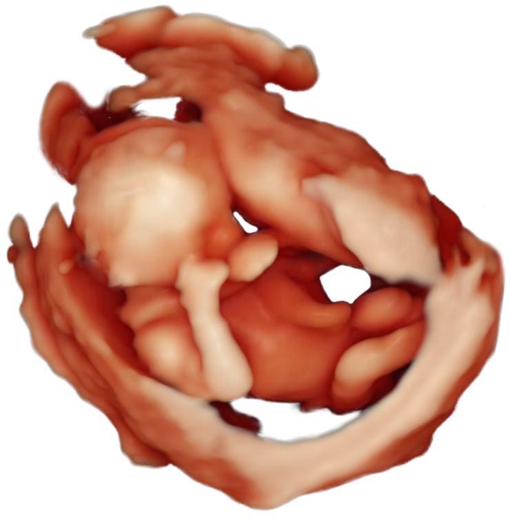 ScanBaby learn baby ultrasound messages sticker-6