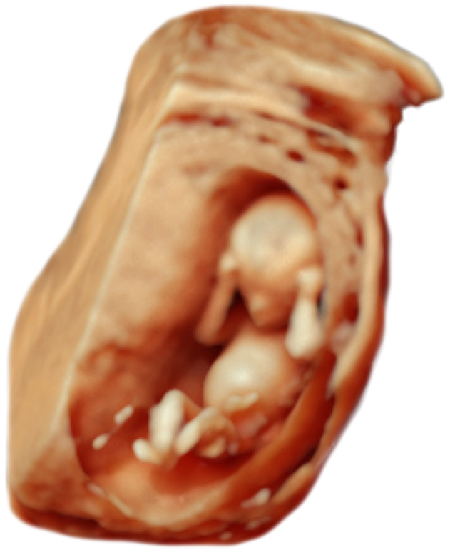 ScanBaby learn baby ultrasound messages sticker-4