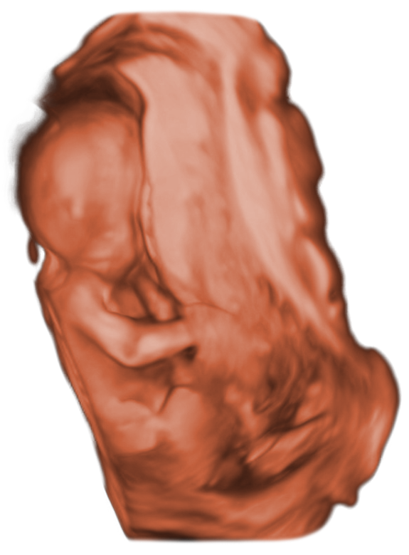 ScanBaby learn baby ultrasound messages sticker-5
